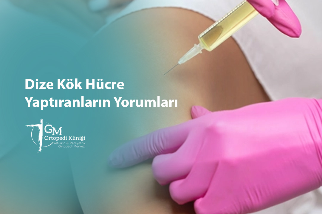 Dize Kök Hücre Yaptıranların Yorumları