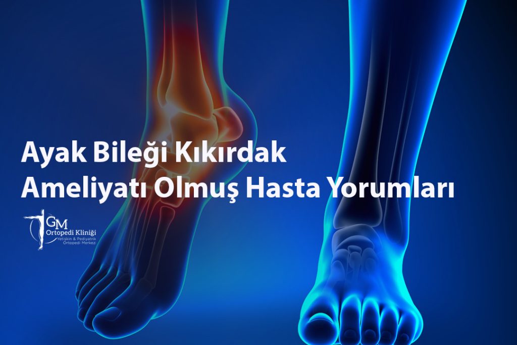 Ayak Bileği Kıkırdak Ameliyatı Olmuş Hasta Yorumları